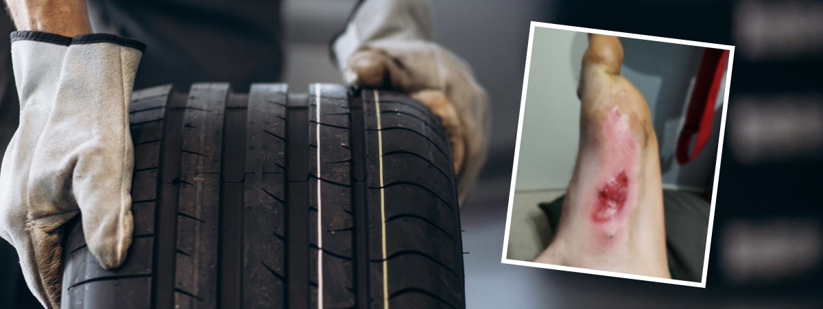 Image of gloved hands rolling a car tyre. There is a picture overlayed of a foot with burn marks.
