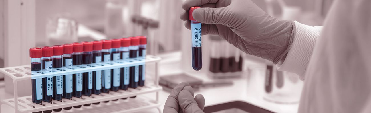 Blood samples being tested to prevent infected blood products