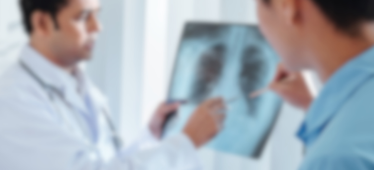 Lung X-ray