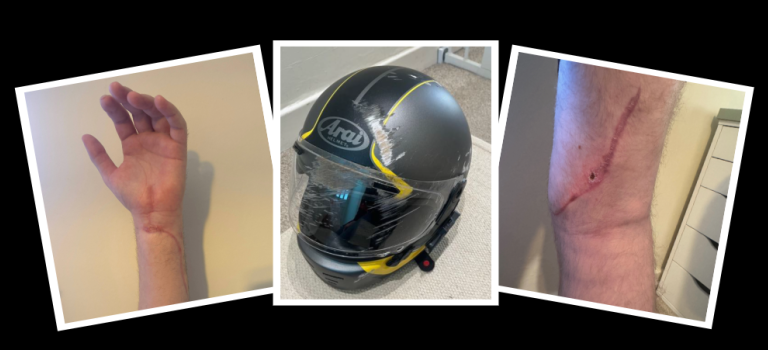Pictures of an injury to the wrist and leg of Barry Evans, along with a picture of his motorcycle helmet with severe srapes